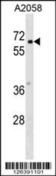 PYRD2 Antibody (N-term)
