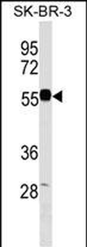 EEPD1 Antibody (C-term)