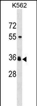 ORNT2 Antibody (Center)