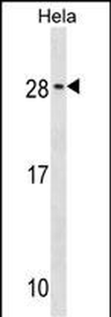 RAB35 Antibody (C-term)