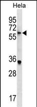 KLH22 Antibody (C-term)
