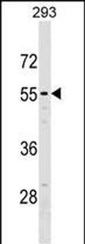NT5D2 Antibody (Center)