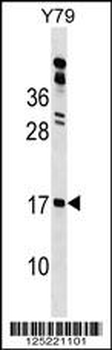 GAPR1 Antibody (N-term)