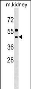 ALG11 Antibody (C-term)