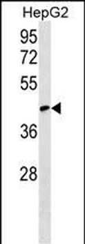 RCSD1 Antibody (Center)