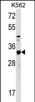 TIPRL Antibody (C-term)