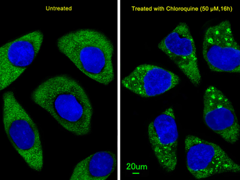 ATG7 Antibody (C-term)