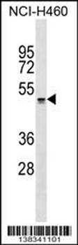 QRFPR Antibody (Center)