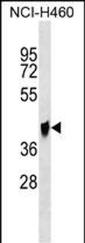 QPCTL Antibody (C-term)