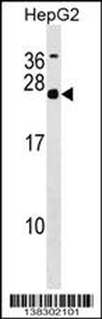 MRGBP Antibody (Center)