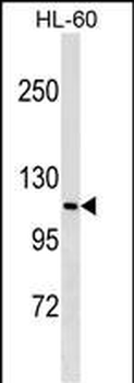 MPHOSPH9 Antibody (N-term)