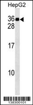 MND1 Antibody (C-term)