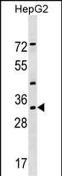 LZTFL1 Antibody (N-term)