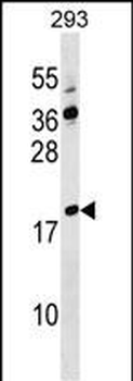 LYZL4 Antibody (Center)