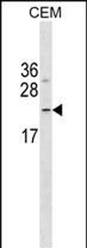 FNDC4 Antibody (C-term)