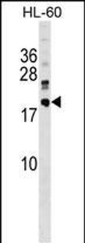 DNAJC30 Antibody (C-term)