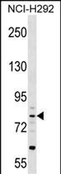 CRTAC1 Antibody (N-term)