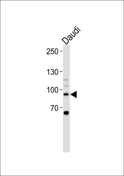 STAT3 Antibody (C-term S727)