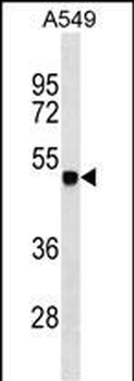 ZSCAN1 Antibody (C-term)
