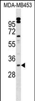 VENTX Antibody (Center)