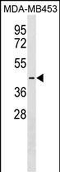 PJVK Antibody (Center)