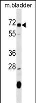 OSGIN1 Antibody (C-term)