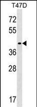 MMADHC Antibody (C-term)