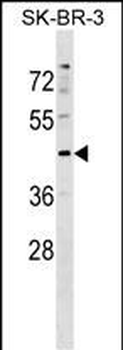 Mouse Stk24 Antibody (Center)