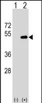 FNTA Antibody (N-term)