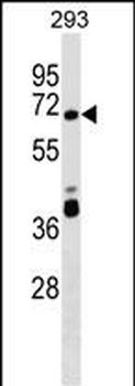 ZNF79 Antibody (N-term)