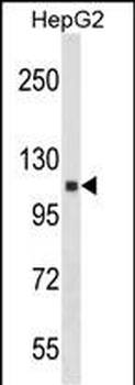 ANKRD18A Antibody (N-term)