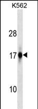 ZFAND2A Antibody (Center)