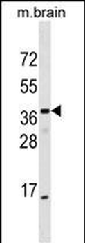 ELMOD1 Antibody (Center)