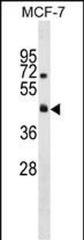 R4RL2 Antibody (C-term)