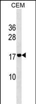 ADM2 Antibody (N-term)