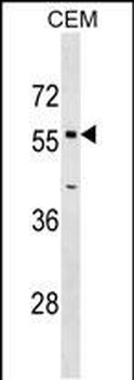 OPTN Antibody (Center)