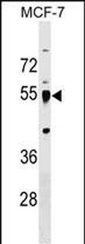 LRRC42 Antibody (Center)