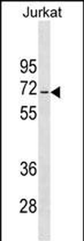 JRKL Antibody (C-term)