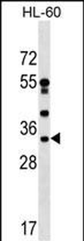 DNAJC17 Antibody (C-term)