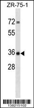 CPPED1 Antibody (C-term)