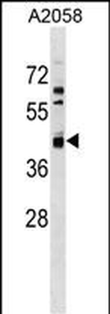 AMDHD2 Antibody (Center)