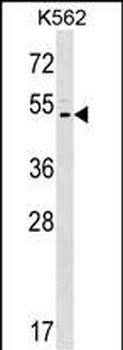 ACCN5 Antibody (C-term)