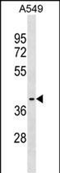 ZNF514 Antibody (N-term)
