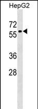 ZNF419 Antibody (Center)