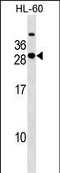 STXBP6 Antibody (Center)