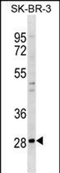 ZNF688 Antibody (N-term)