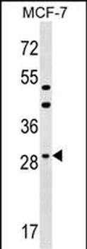 DHRS11 Antibody (Center)