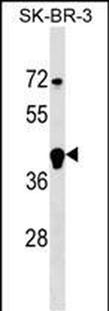 FBXL12 Antibody (C-term)