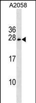 CHCHD6 Antibody (Center)
