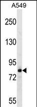 FSCB Antibody (C-term)